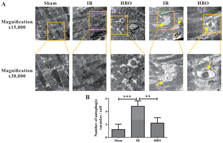HBOT inhibits mitochondrial dysfunction and autophagy and protects myocardial cells