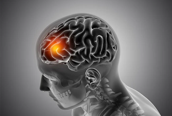 Hyperbaric Oxygen Treatment is a Key Factor in Treating TBI